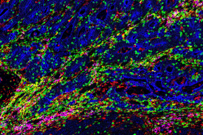 About Cancer Immunogenomics